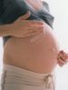 Растяжки во время беременности